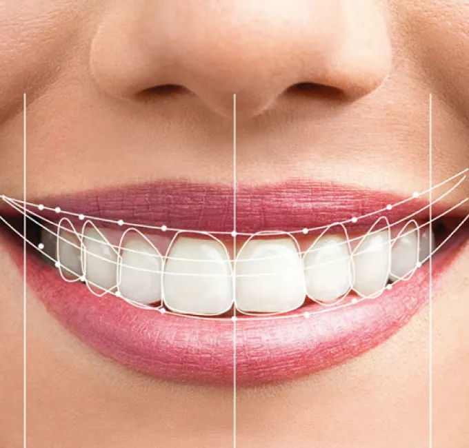 Cosmetic Dentistry