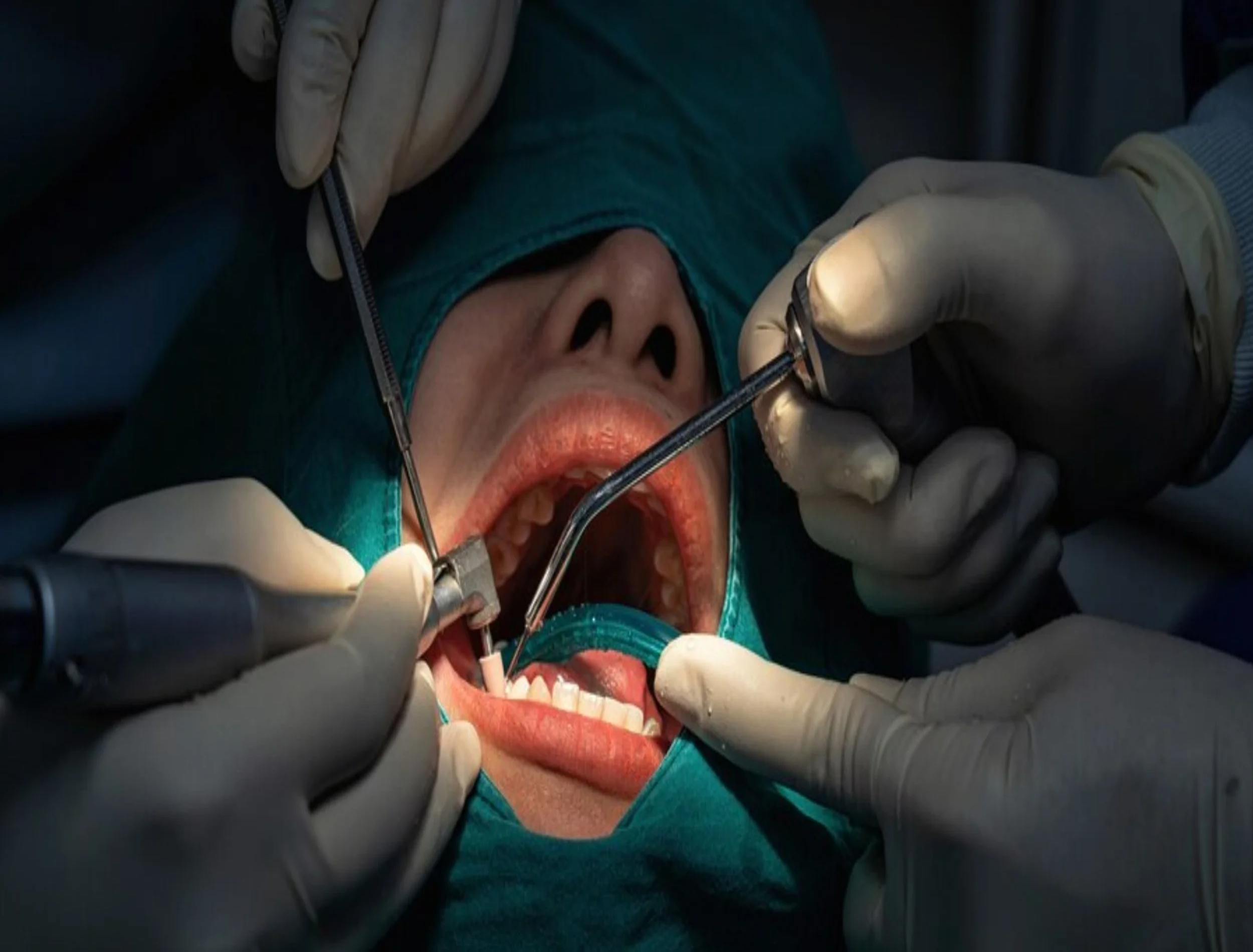 Dental Surgery