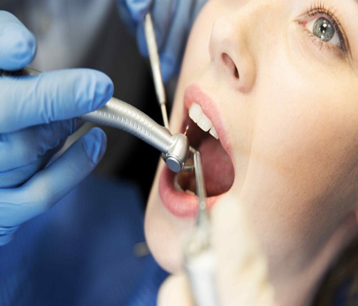 Root canal treatment
