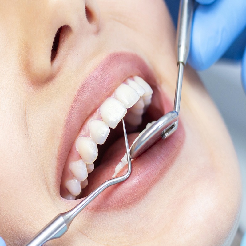 Dental Treatments