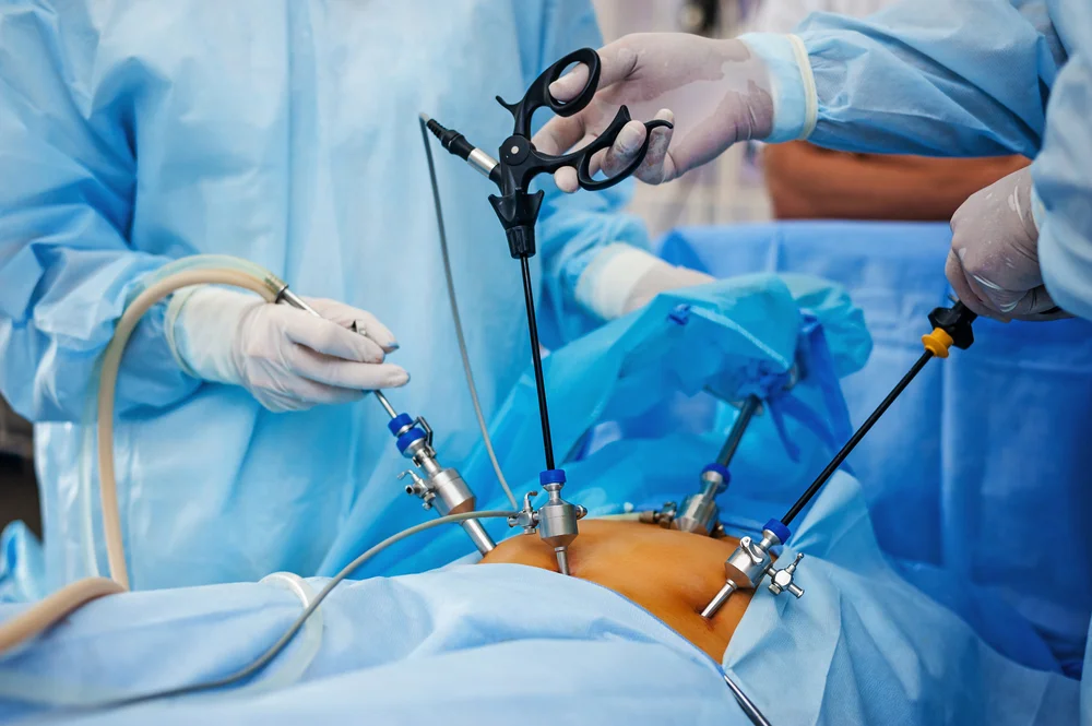 Laparoscopic Surgery Department